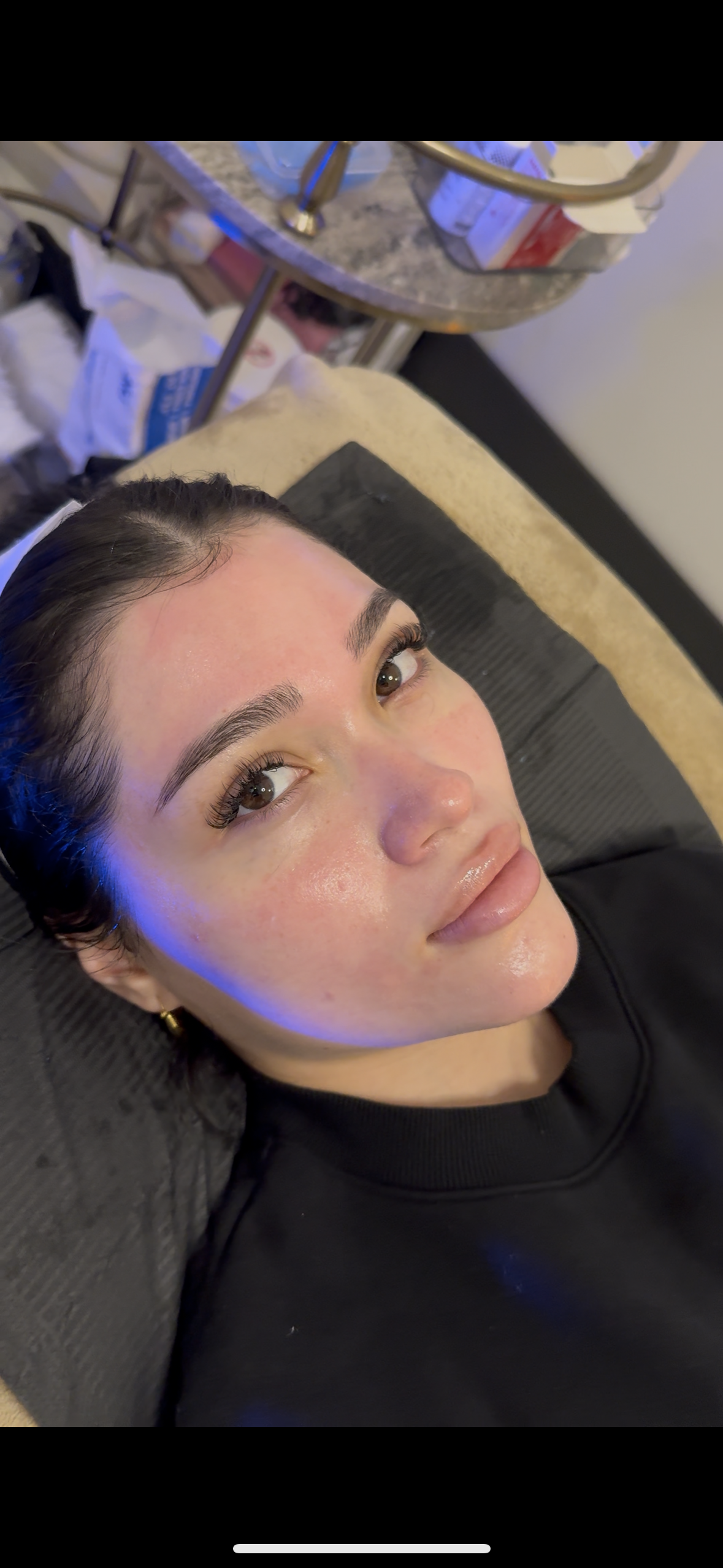 Microneedling x Facial