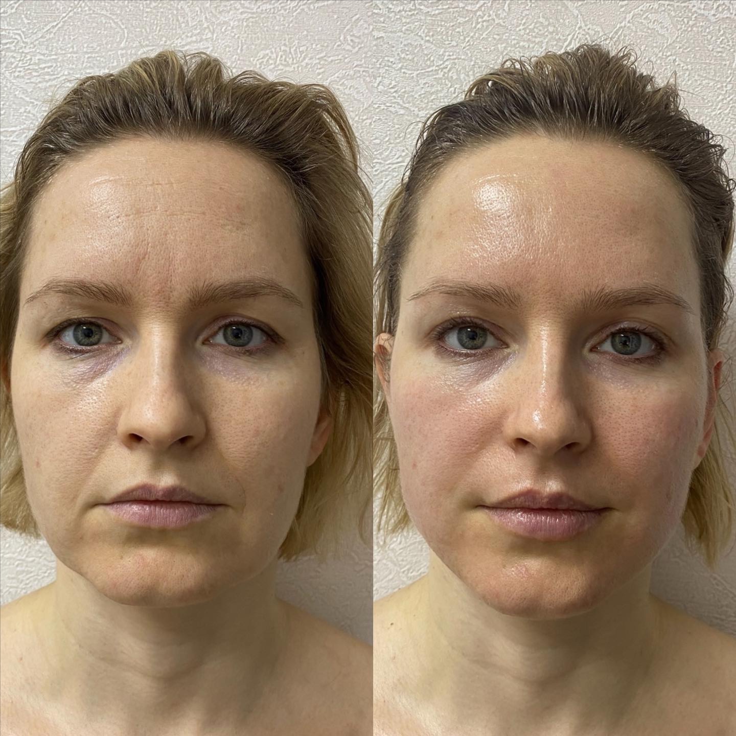 Lifting Lymphatic Facial Massage at Healthy skin by Alvina in Highland Park, IL