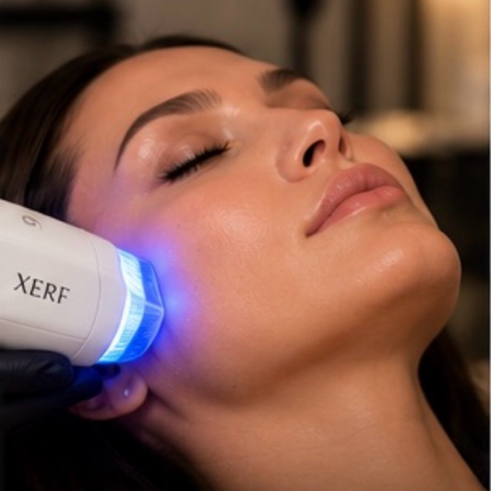 Xerf at Beauty Perfections Med Spa in Sunny Isles, FL
