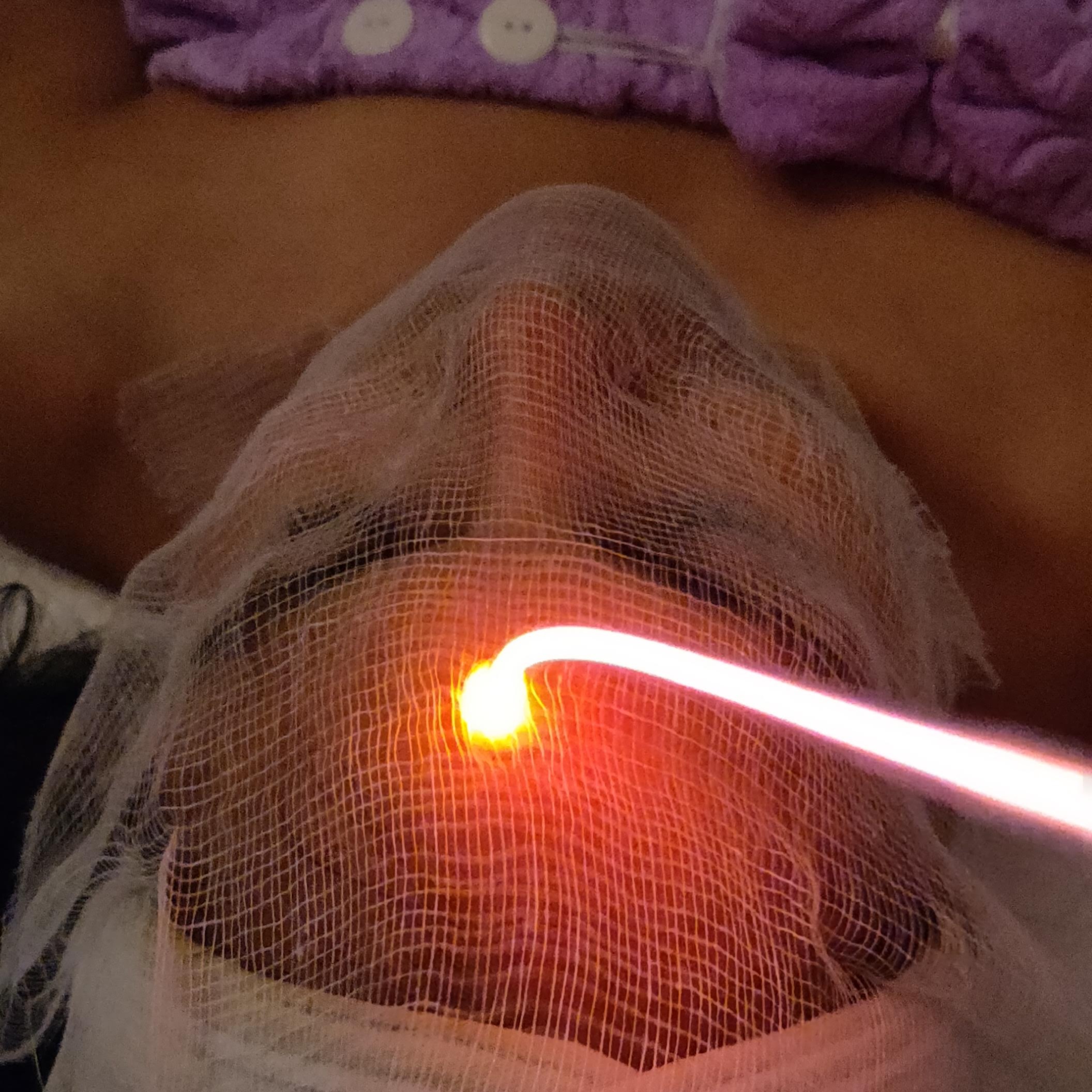 DEEP CLEANSING (LIMPIEZA PROFUNDA)