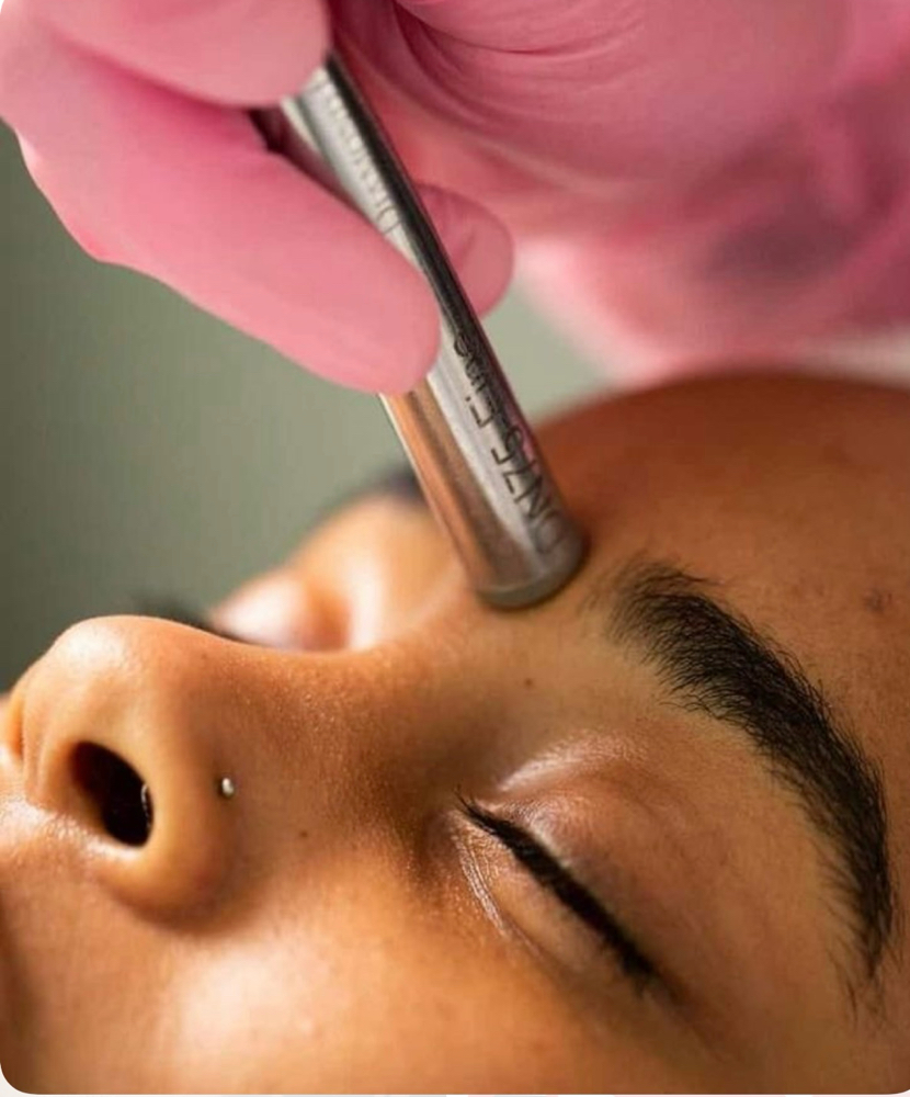 Microdermabrasion Facial at Caro’s Beauty Bar in Collierville, TN