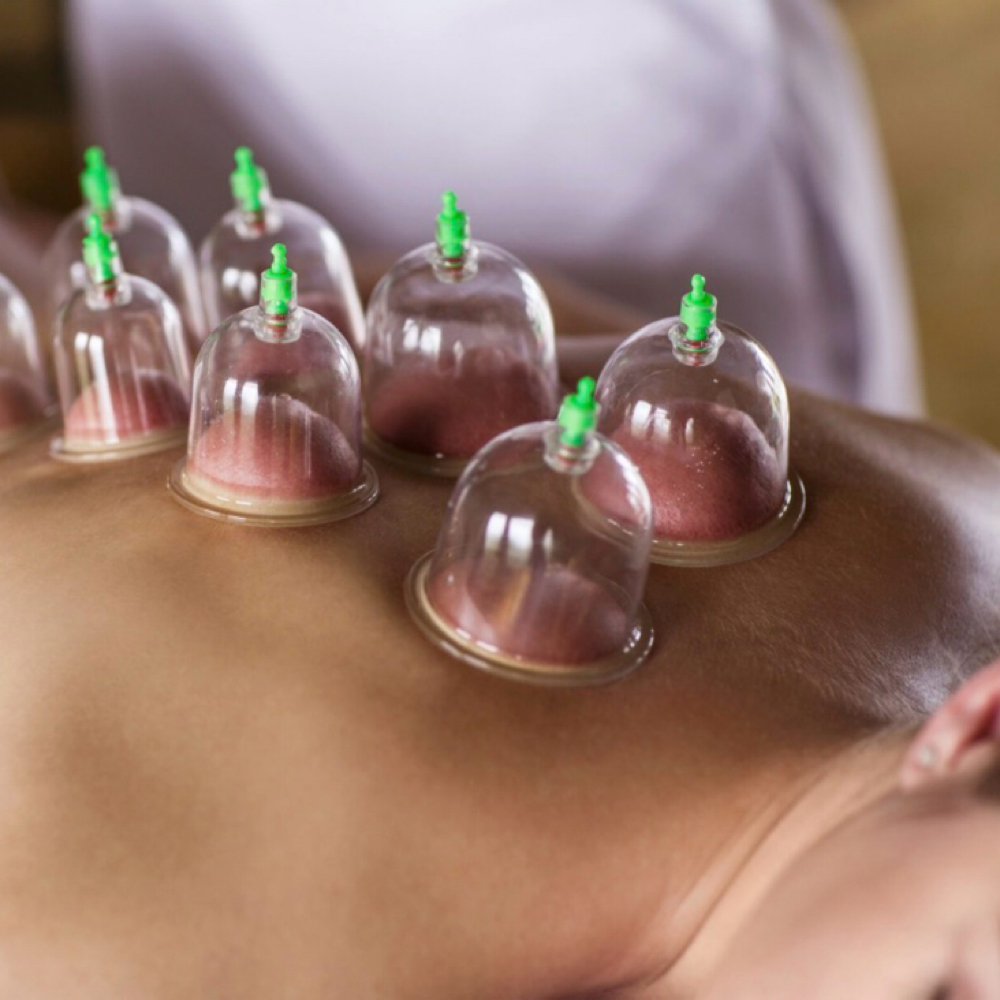 Cupping Therapy (Add On) at West View Salon & Spa in Fairview Park, OH