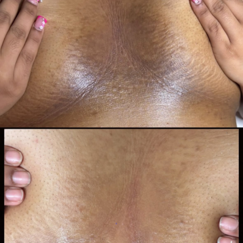 Pretty Tone at Gabriellas self care studio in Mesquite, TX