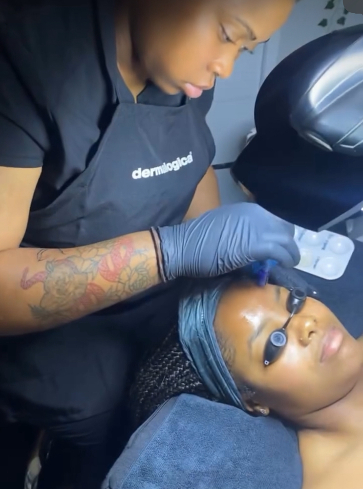 Microneedling at Shae’s SKKN Studio in Baton Rouge, LA