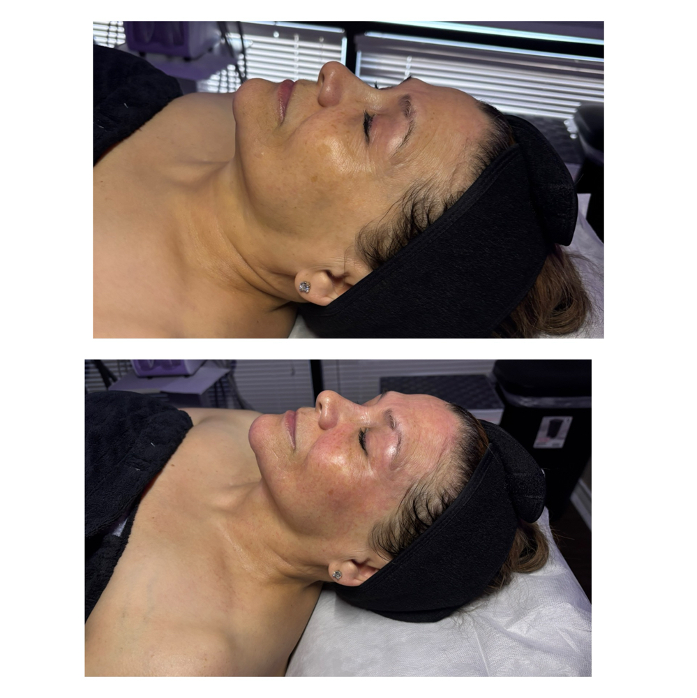 Peptide Firming