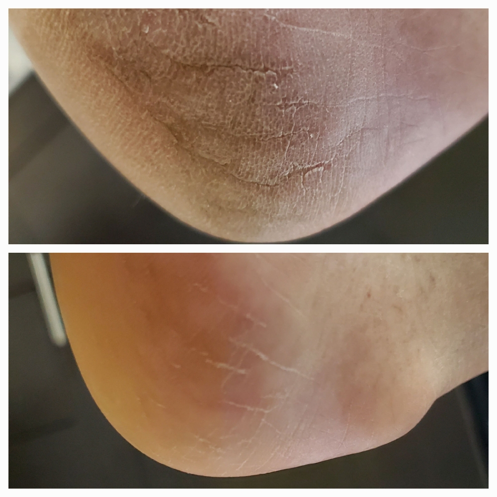 Restoration Pedicure