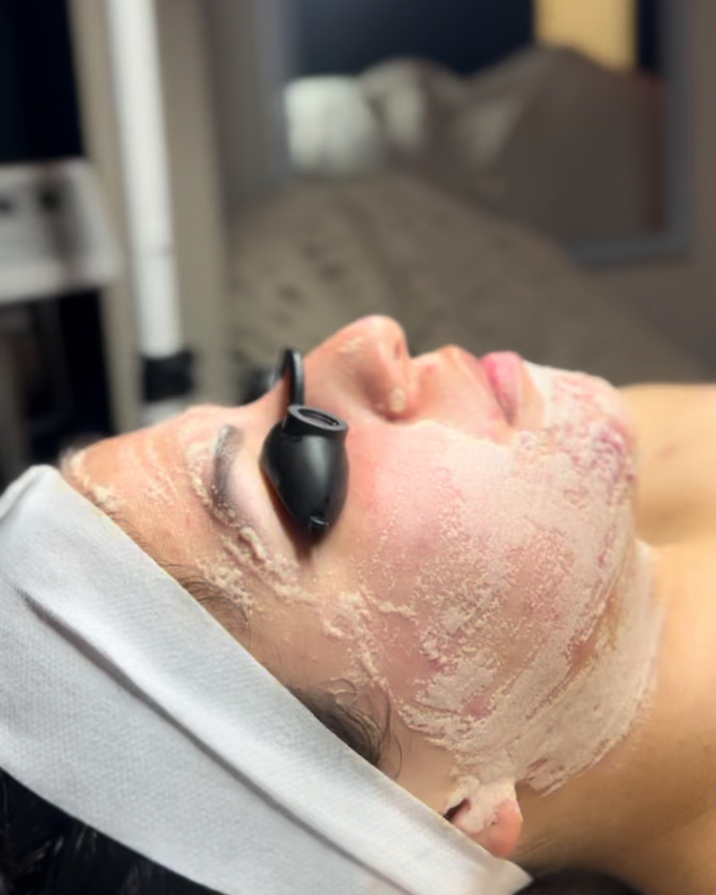 V Oxygen Facial