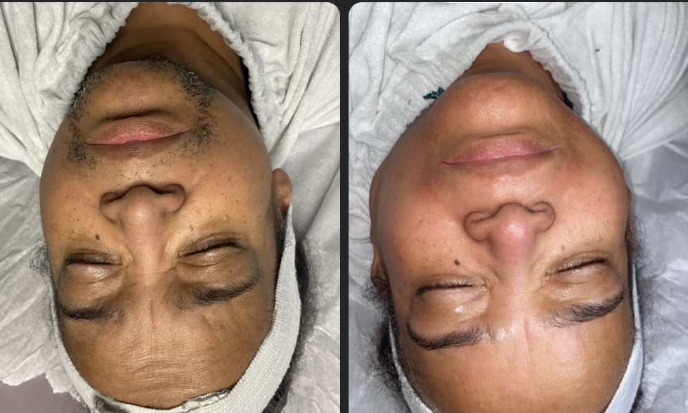 Full Face Wax