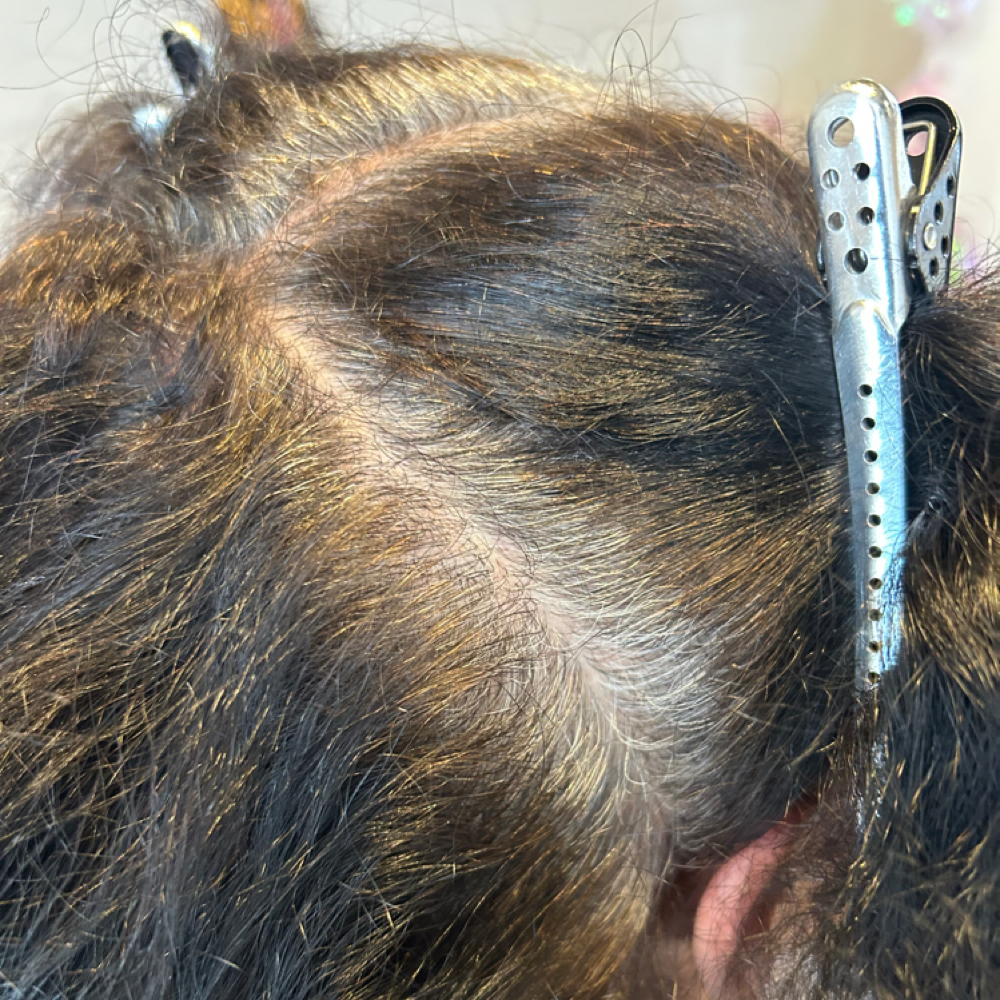 Single Root Touch UP at Edgar  Gutierrez in Bakersfield, CA
