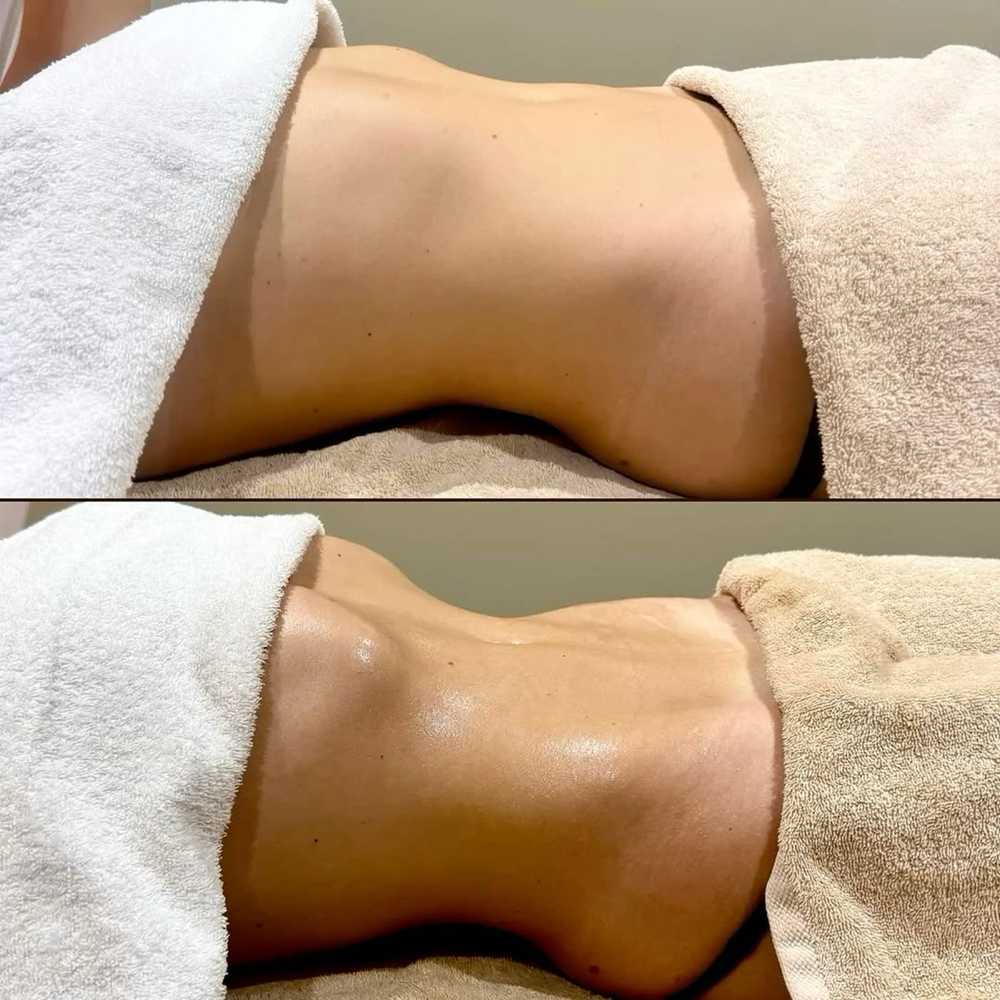 Body Sculpt Special (destiny) at Babes Esthetics in Reno, NV