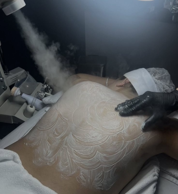 Back Facial with Hot Stones