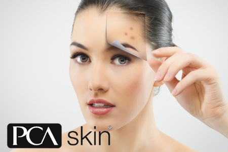 PCA Peel With Hydroquinone