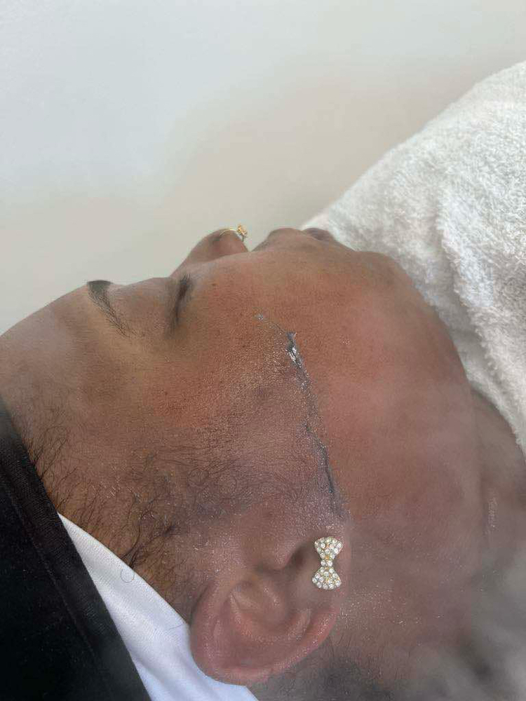 Dermaplaning Add On
