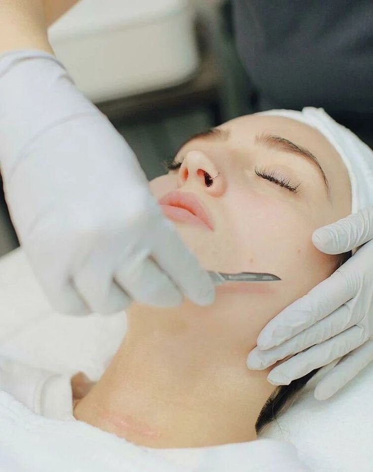 Dermaplaning