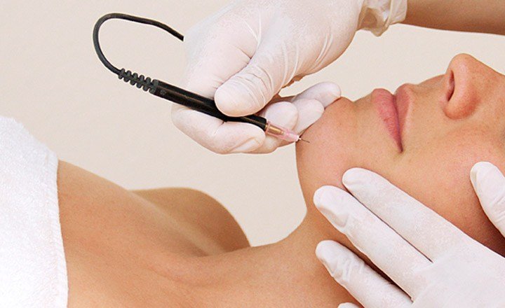 Electrolysis (1 Hour)