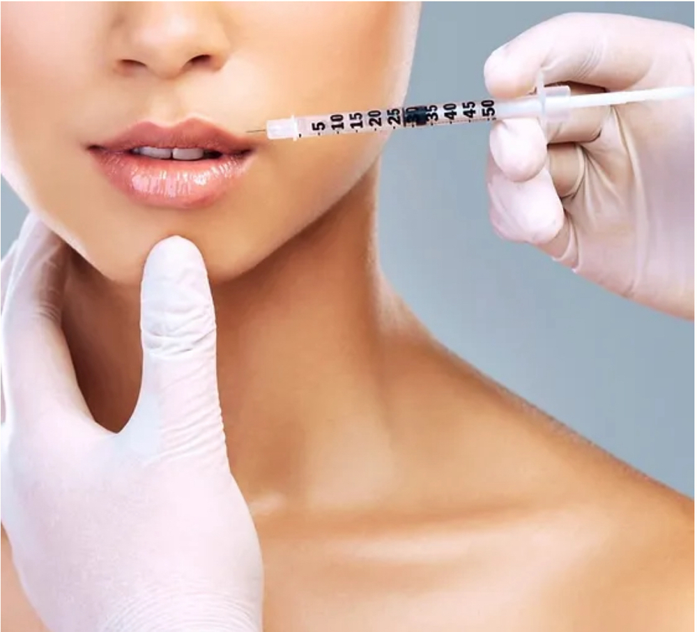 Dermal Fillers