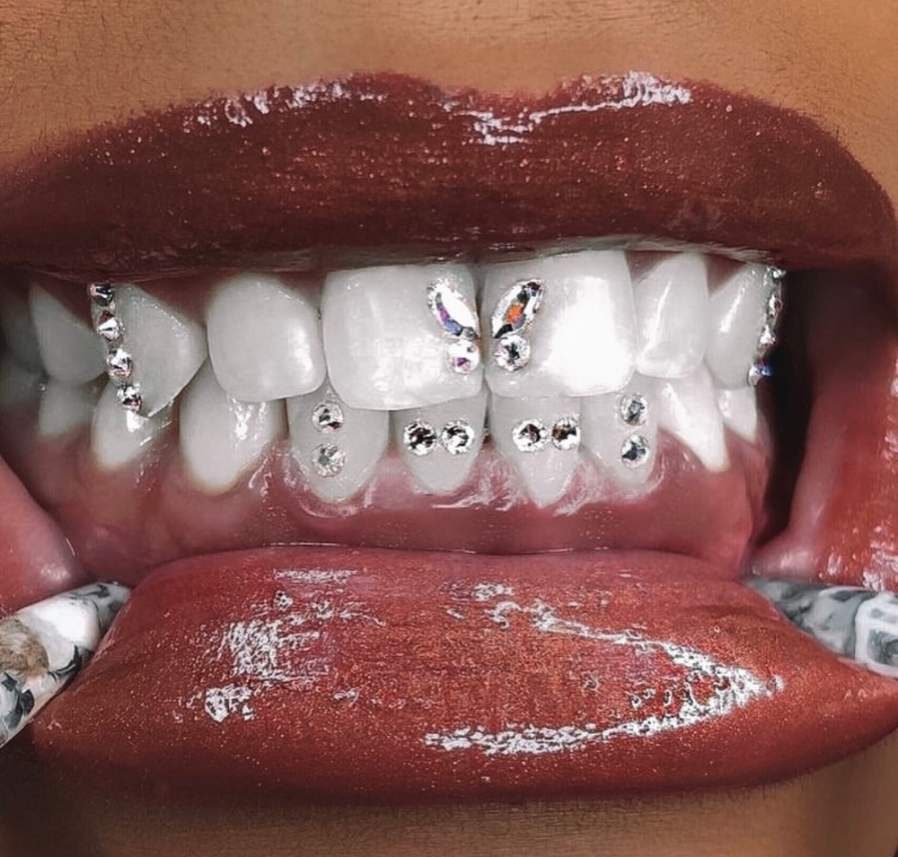 Freestyle Full Mouth Of Tooth Gems