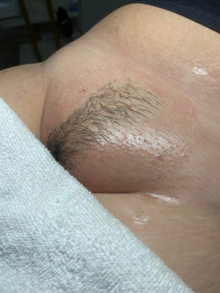 French Bikini Wax
