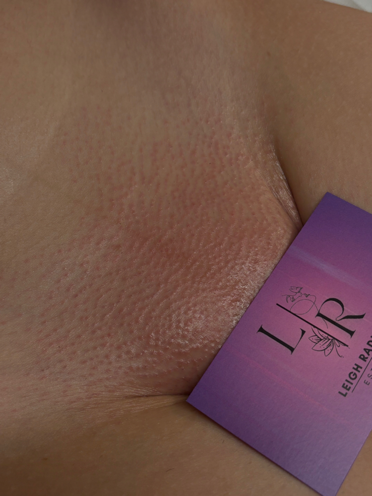 Brazilian Wax (Maintenance) at Leigh Radiance in Staunton, VA