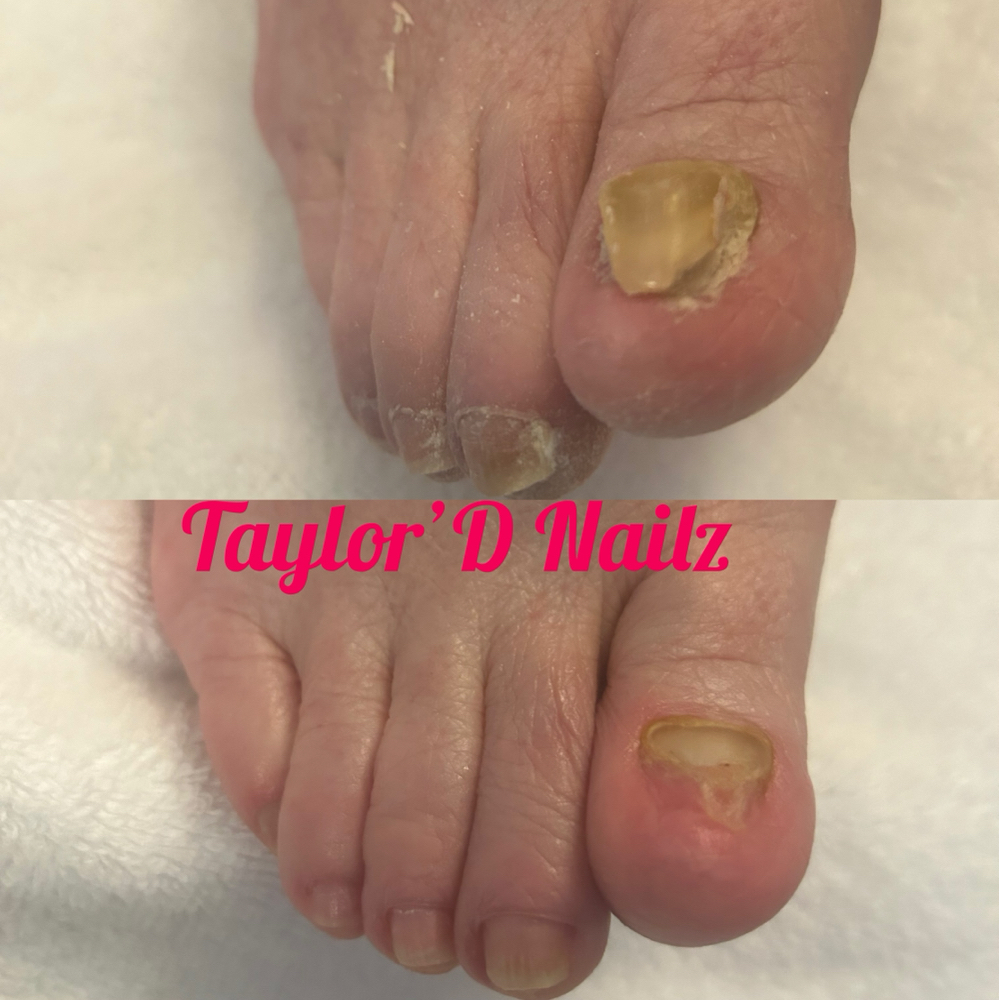 Waterless Medical Wellness Pedicure