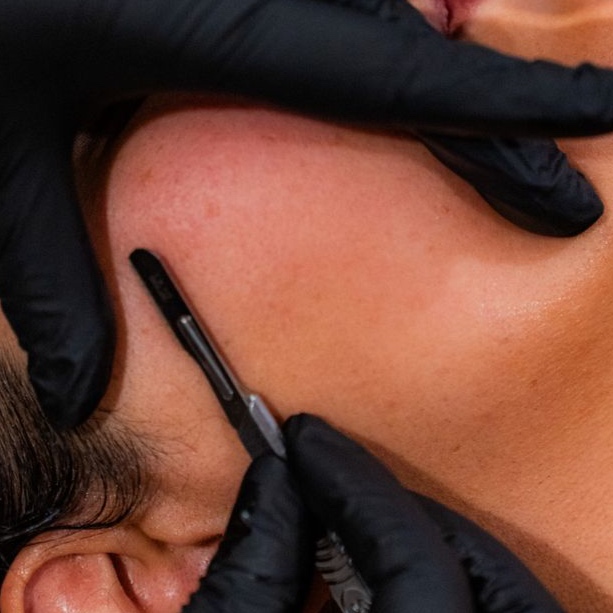 Add- On Dermaplaning at Treatments by Rebekah Linnane in Auburn, CA
