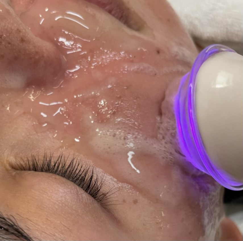 Bare Glow O2 Facial at Fairy Glow Studio in Toledo, OH