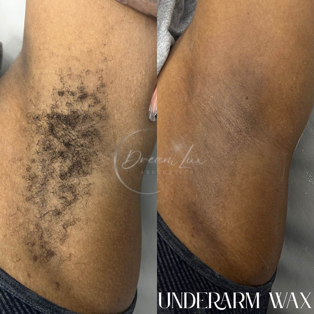 Underarm Wax