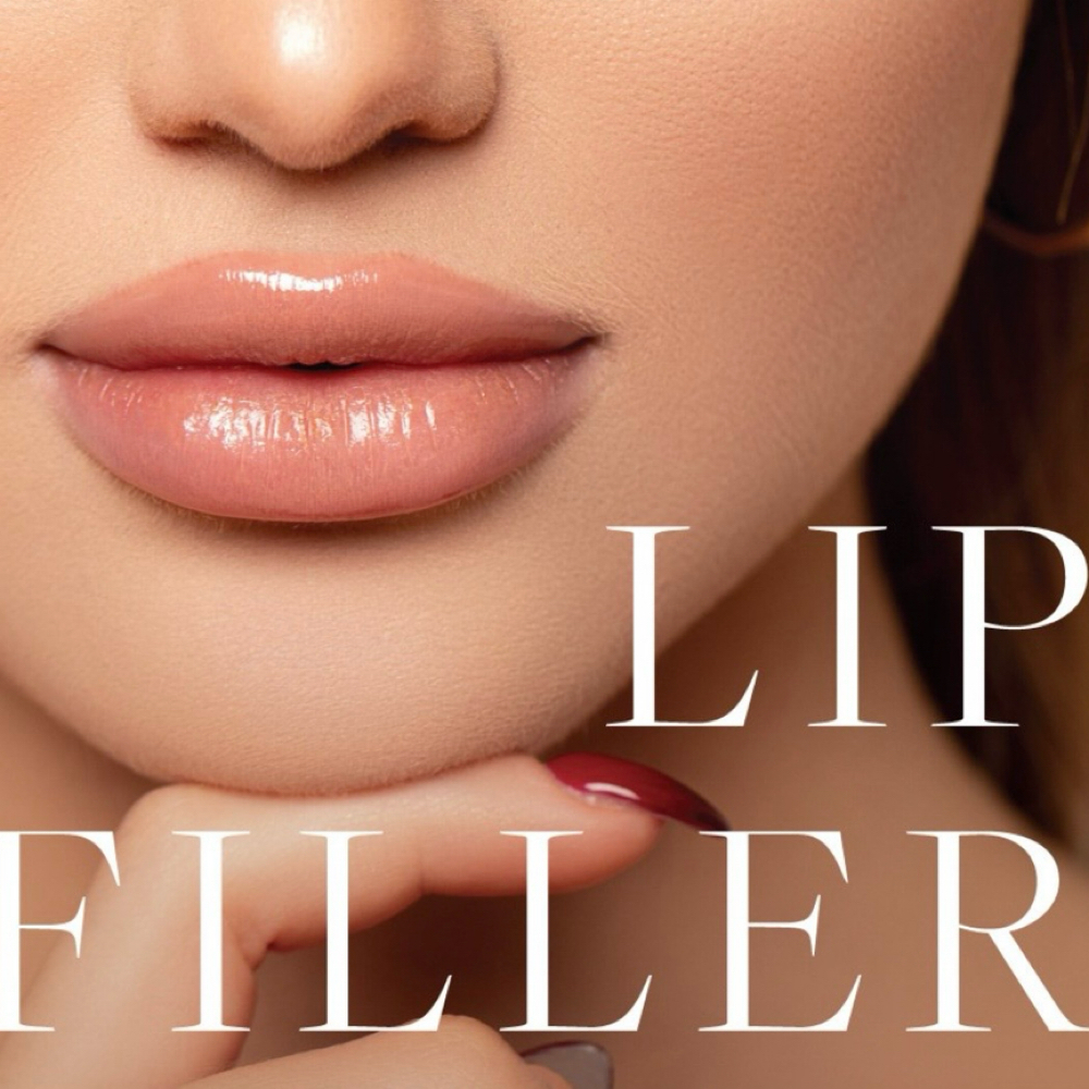 Follow Up Lip Filler at Radiant Aesthetics by Liz in El Paso, TX