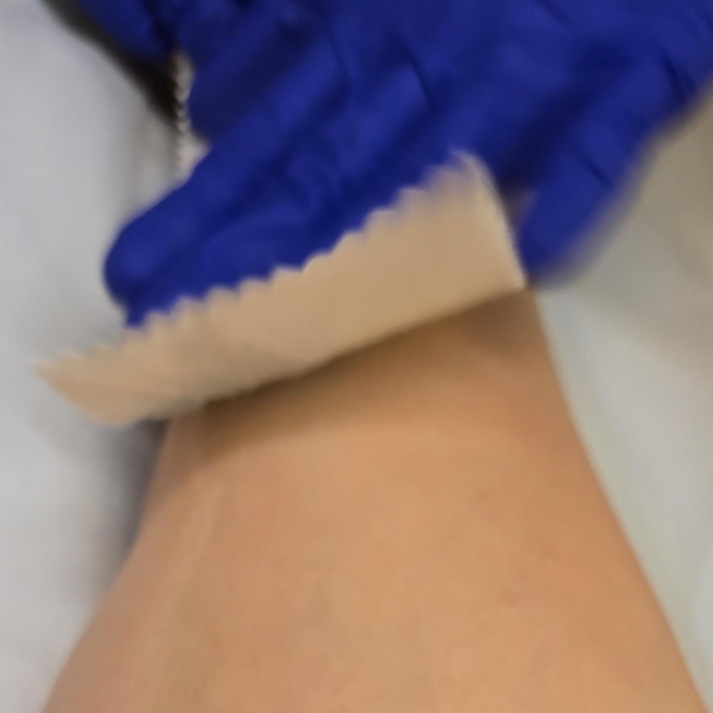 Underarm Wax at Midtown Esthetics in Raleigh, NC
