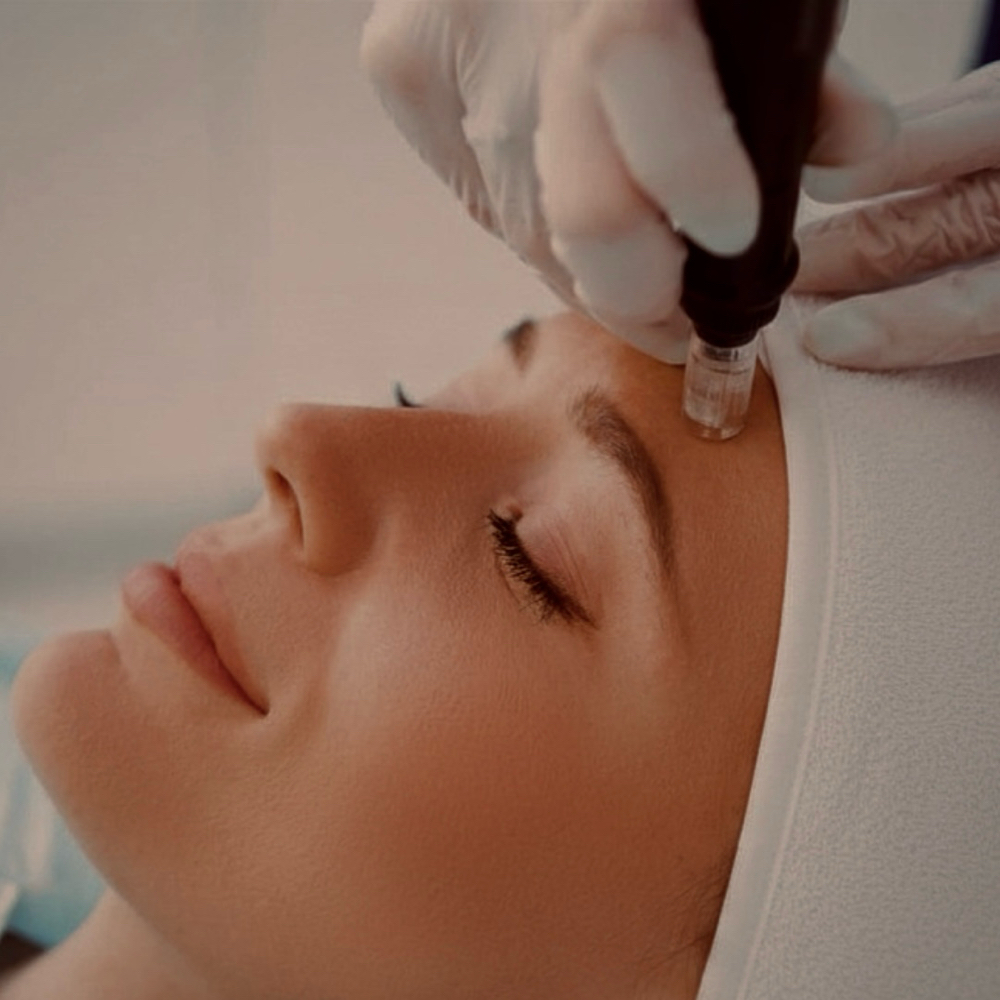 Microneedling at Skin Care by Kayla in Martinez, GA
