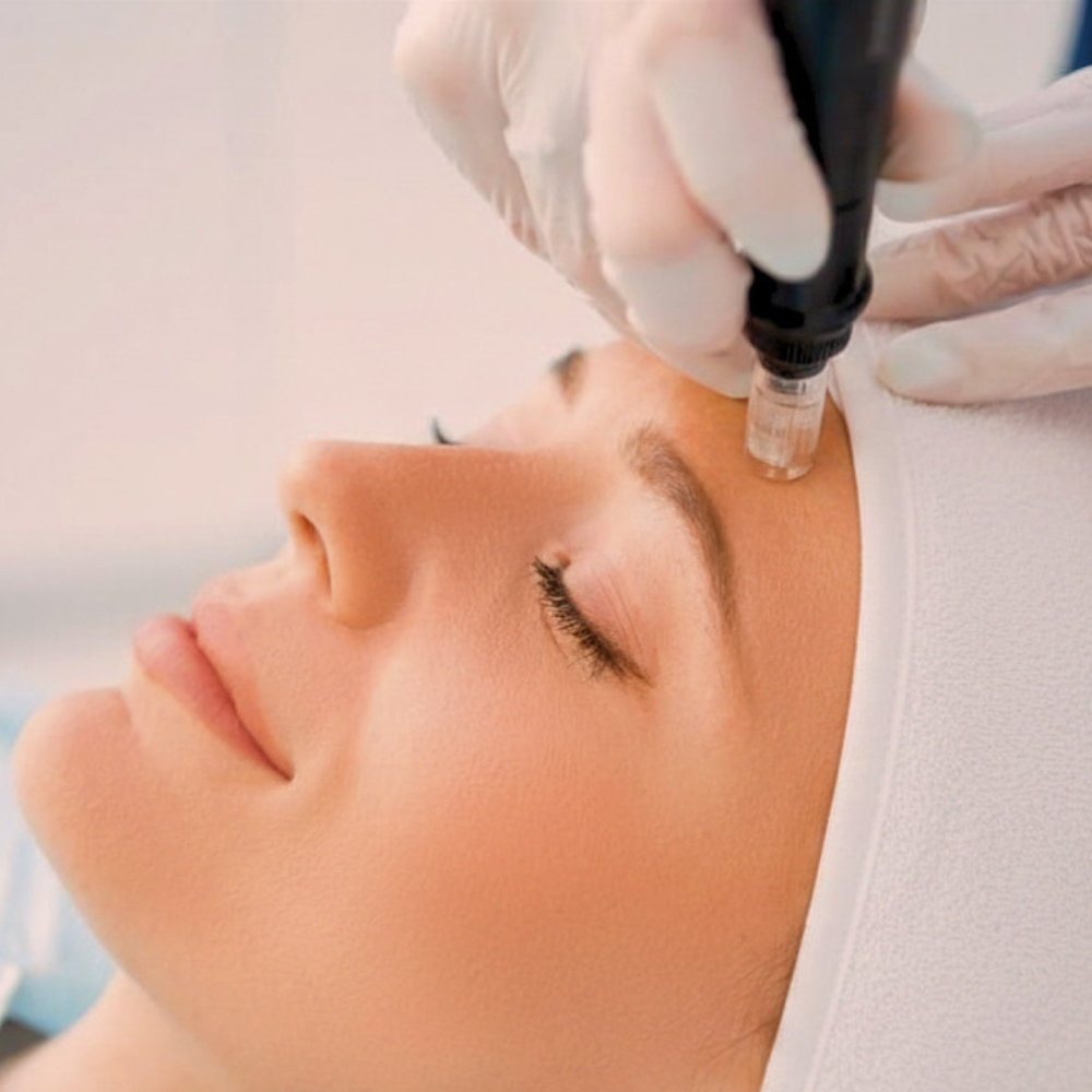 Microneedling at Skin Care by Kayla in Martinez, GA