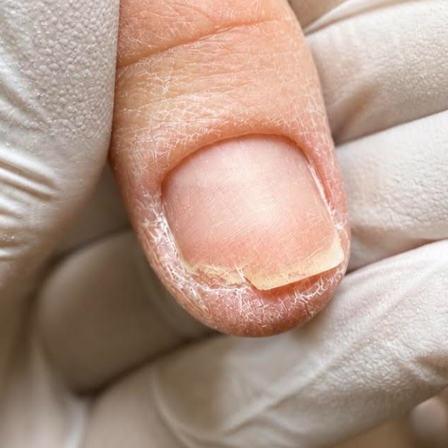 NailRepair at mios mani in Dorchester, MA