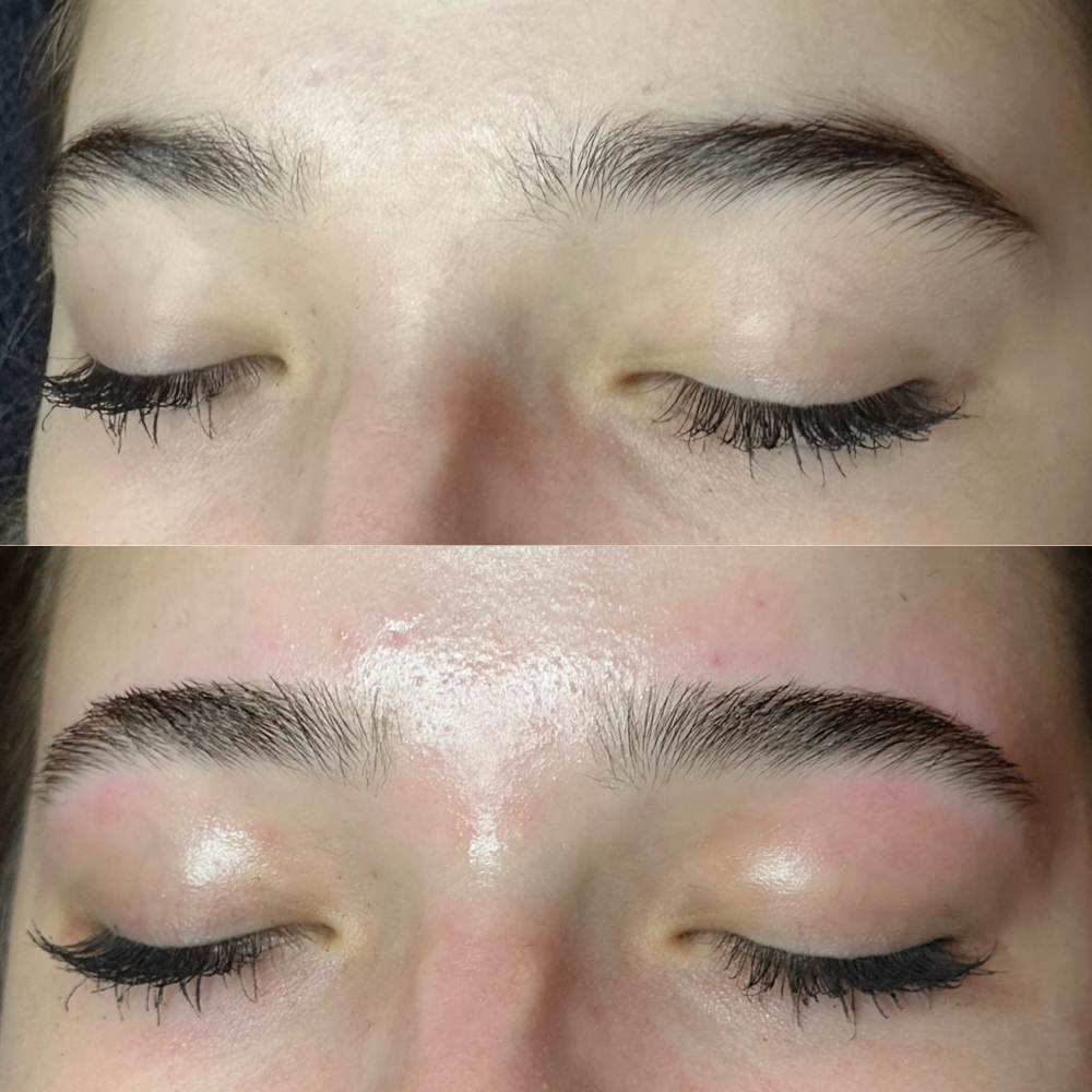 Brow Shaping