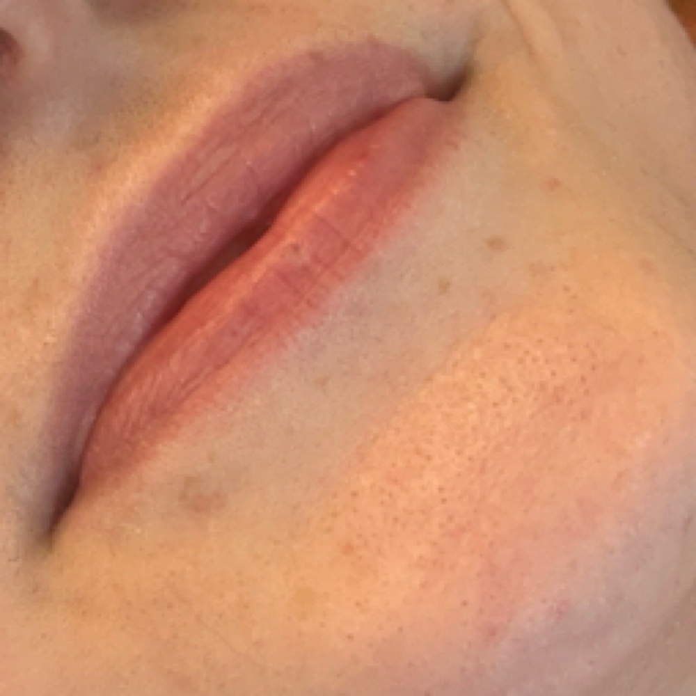 Lip Flip at Genesis Health and Beauty Bar in Daphne, AL