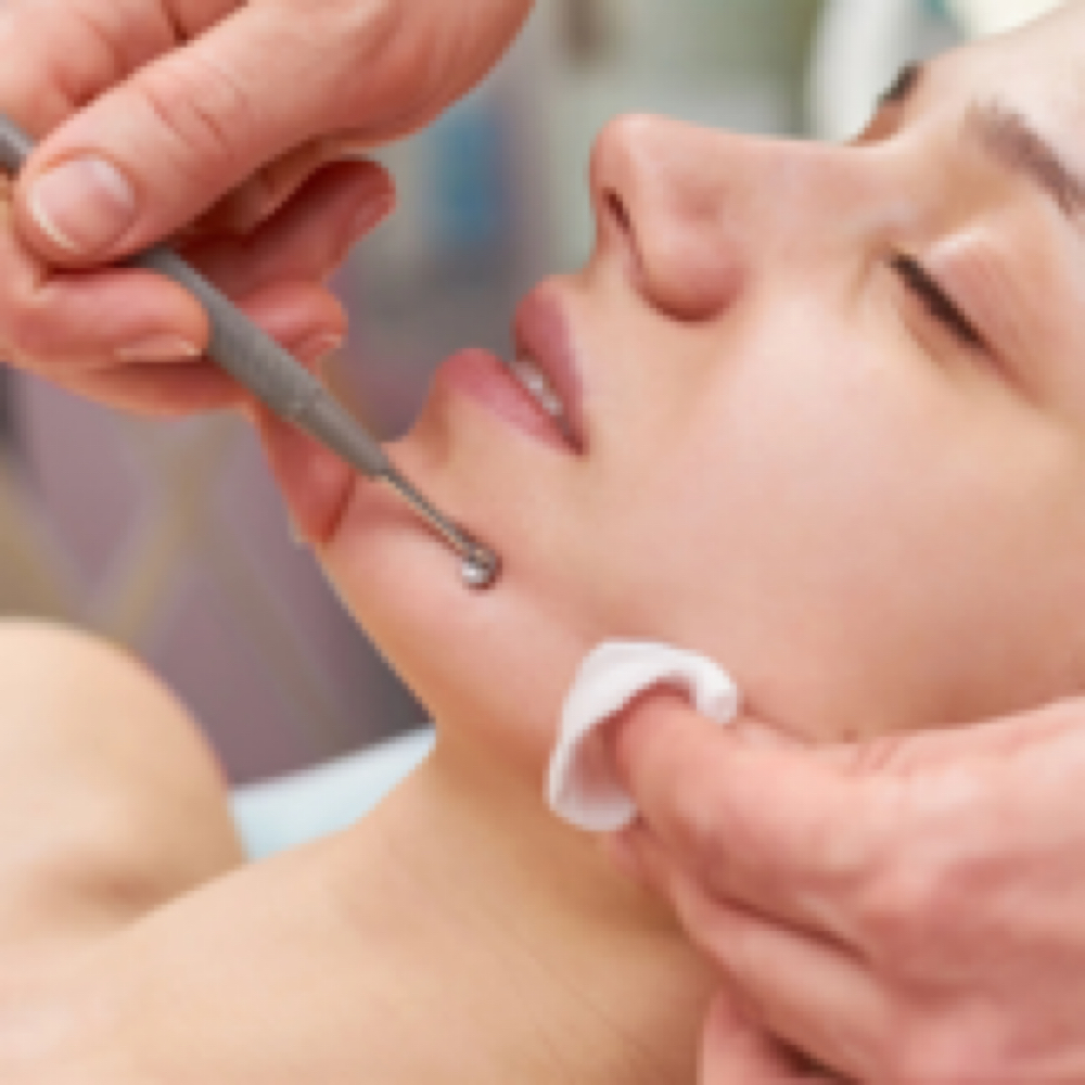 Intensive Extractions at The Layer & The Spell by Rexstyles in Point Pleasant Beach, NJ