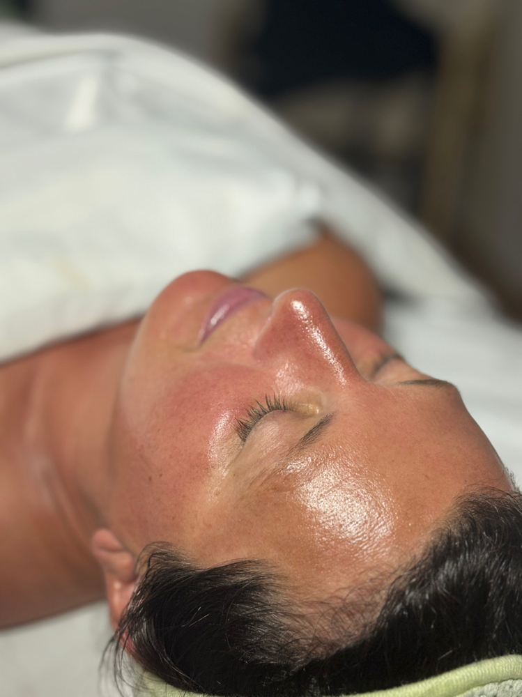 Dermaplaning Treatment