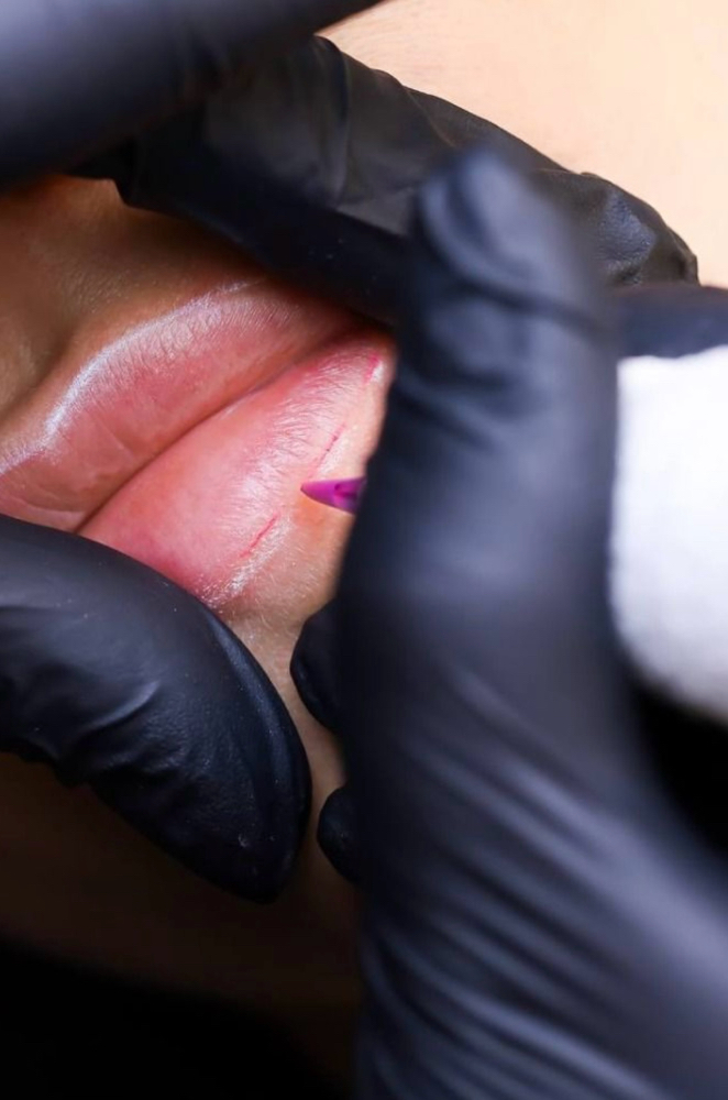 Lip Blushing