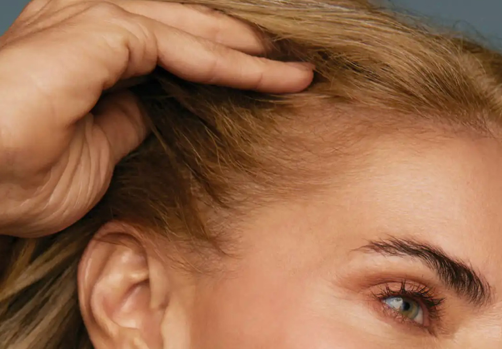 Hairline Color