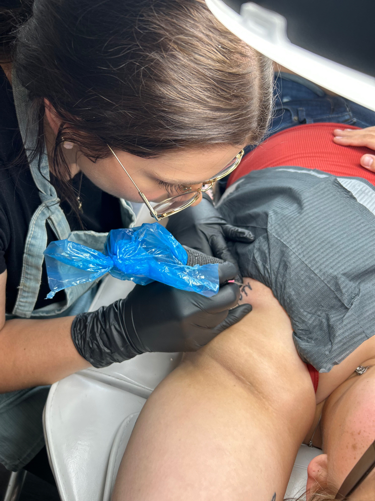 Tattoo removal