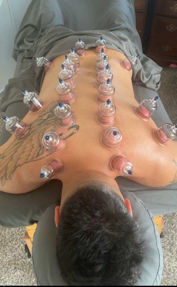 Cupping & Red Light Therapy