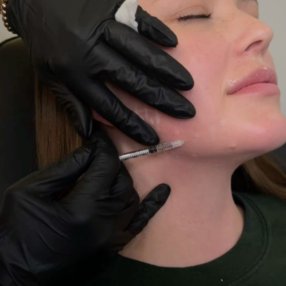 May Special | Nefertiti + DAO at Bare Aesthetics ATX in Austin, TX