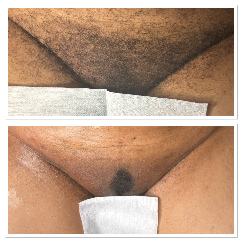 Brazilian Wax (V) at Shay’s Peaceful Escape, LLC in San Antonio, TX