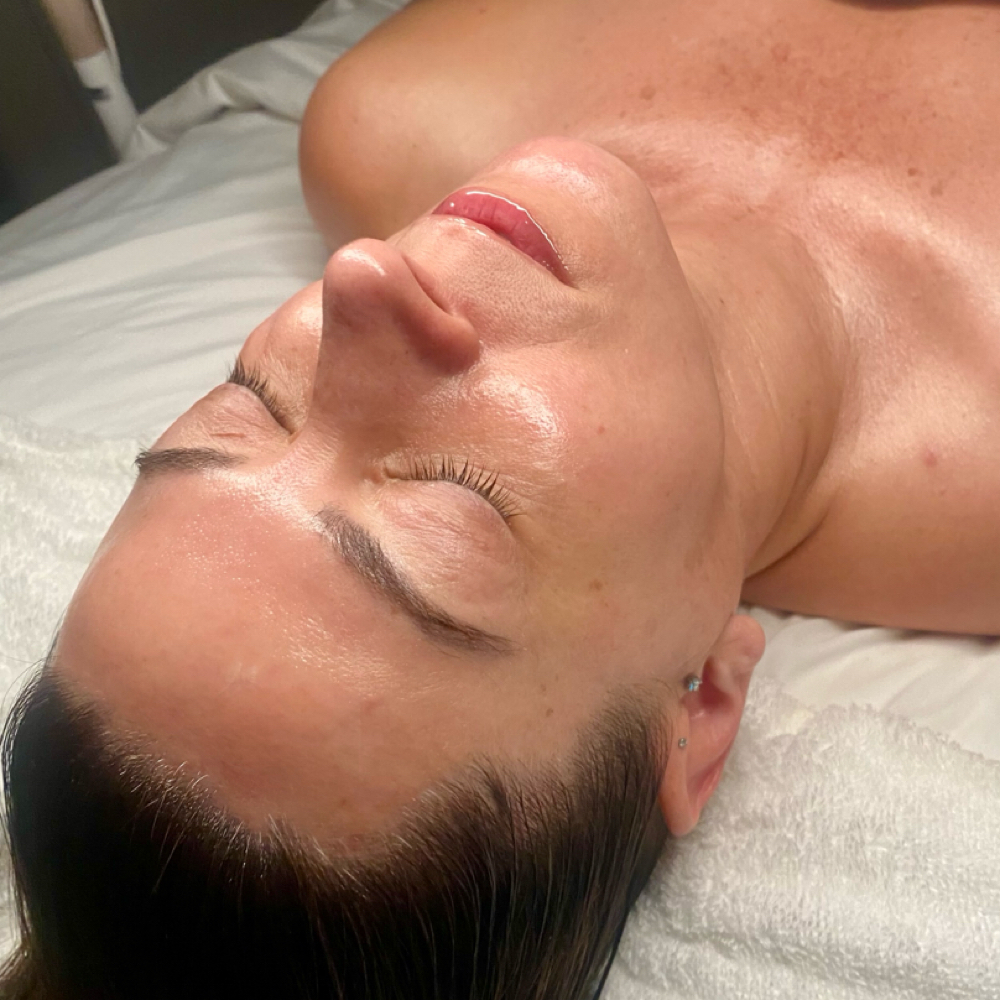 Express Dermaplaning Facial at Lori Aesthetics in Weymouth, MA