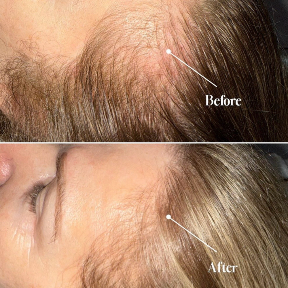 Keravive Hair Restoration at Anfissa Beauty in Mount Angel, OR