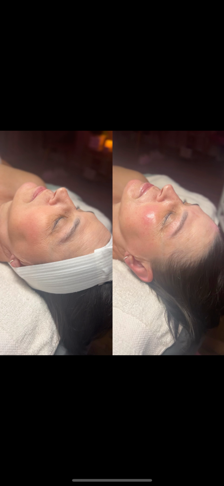 The Ultimate Go And Glow Facial