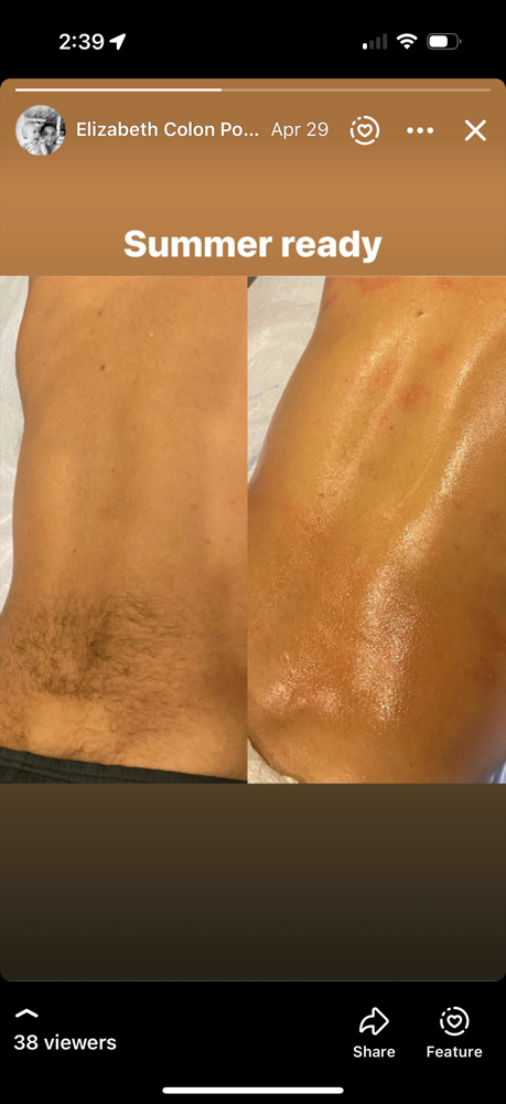 Chest / Back Wax