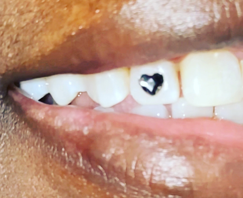 Heart Tooth Gem