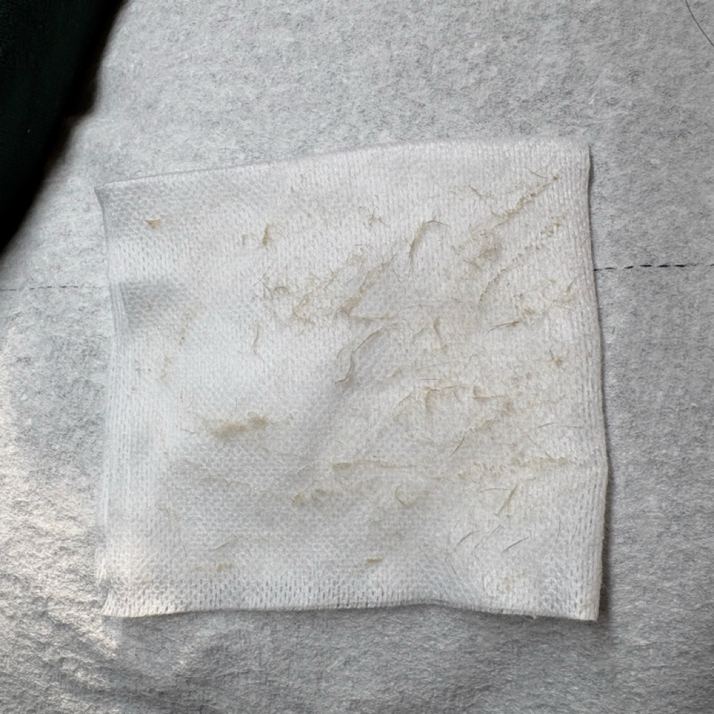 Dermaplane Facial Treatment