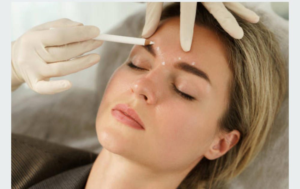 Neurotoxin Inj/ Established Clients