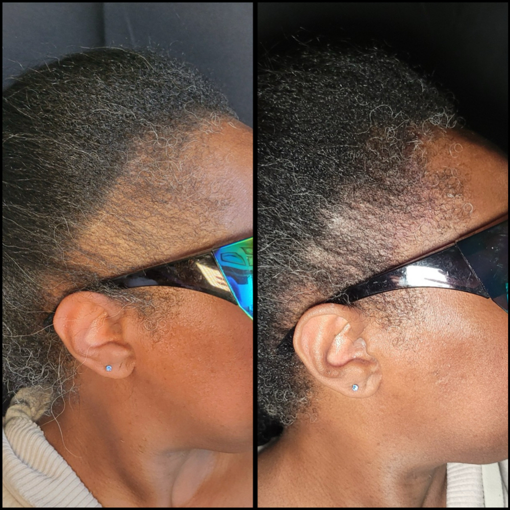 Women’s Edge SMP Promo ✨